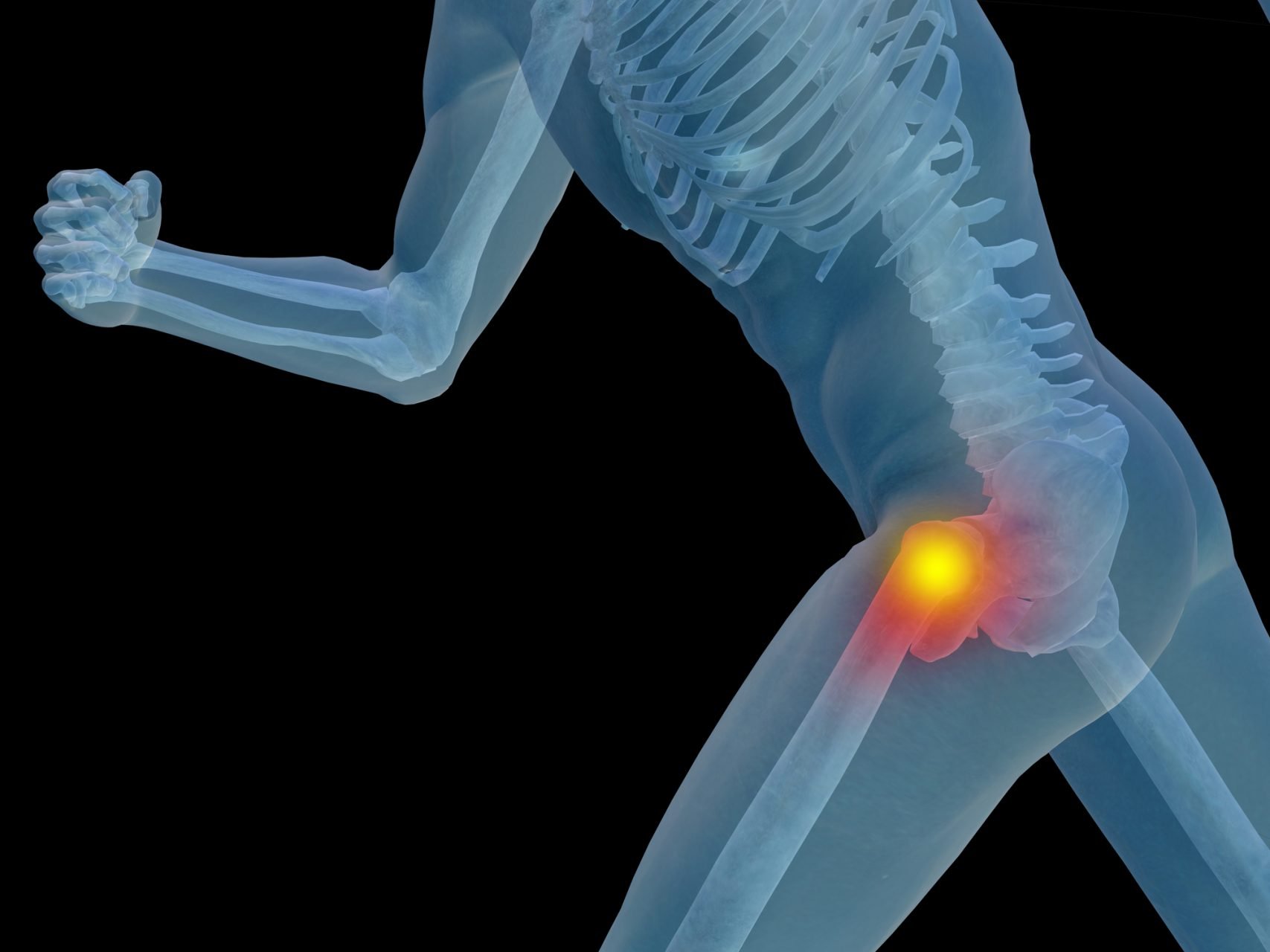 Bursitis Oroville Acupuncture